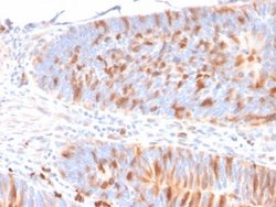 MBD1 Antibody (CPTC-MBD1-1) - Azide and BSA Free, Novus Biologicals 100